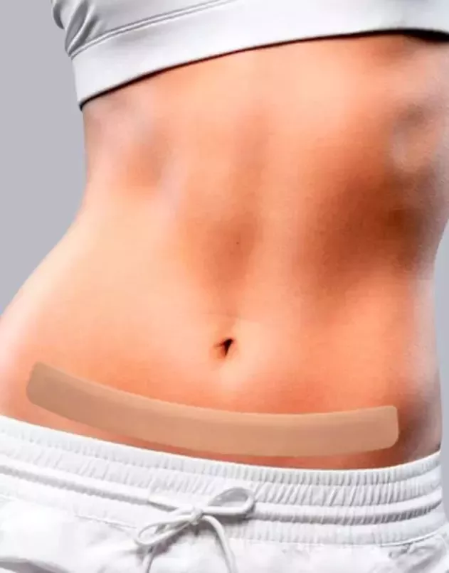 Fitas de Silicone