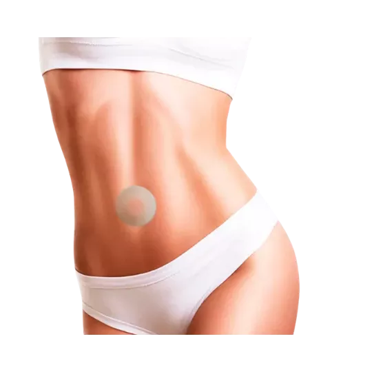 Fita de Silicone Pós Abdominoplastia – NullScar® Órtese Umbilical