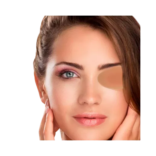 Fita de Silicone Pós-Cirúrgica – NullScar® Tape Eye